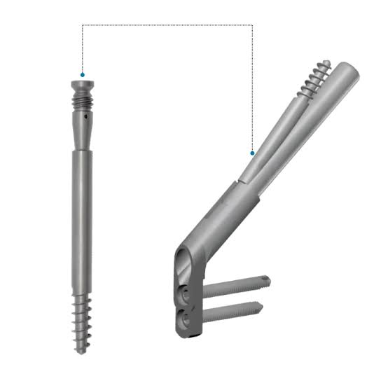 Fracture Fixation Implant